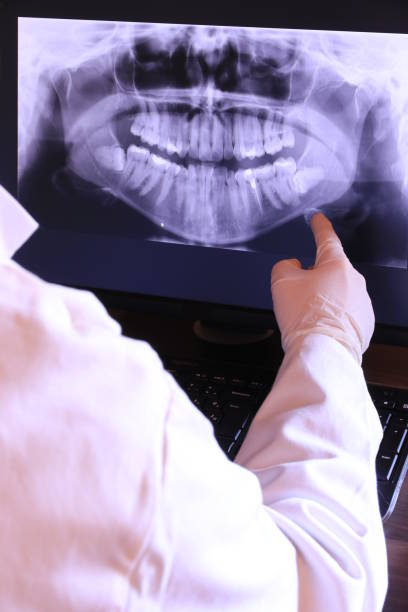 Best Dental Abscess Treatment in Perryton, TX